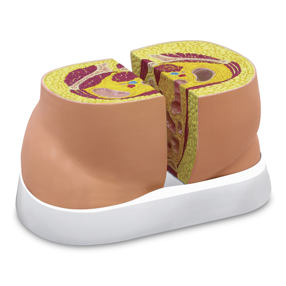 WA25908-Obesity Model