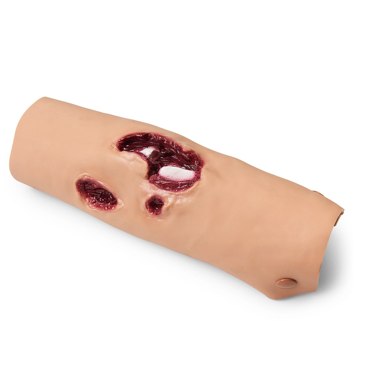 800-6761-Compound Fracture - Tibia