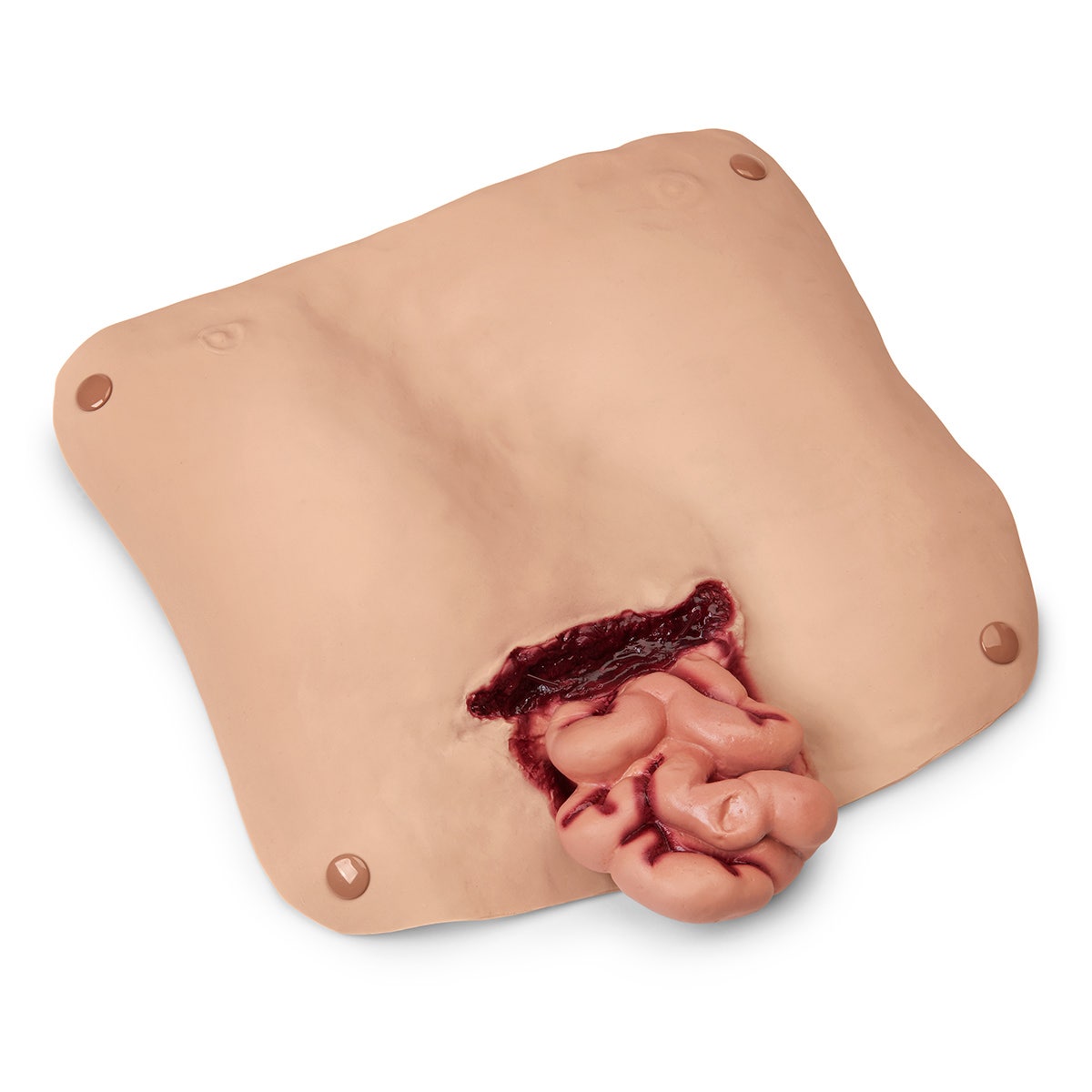 800-6808-Abdominal Wound
