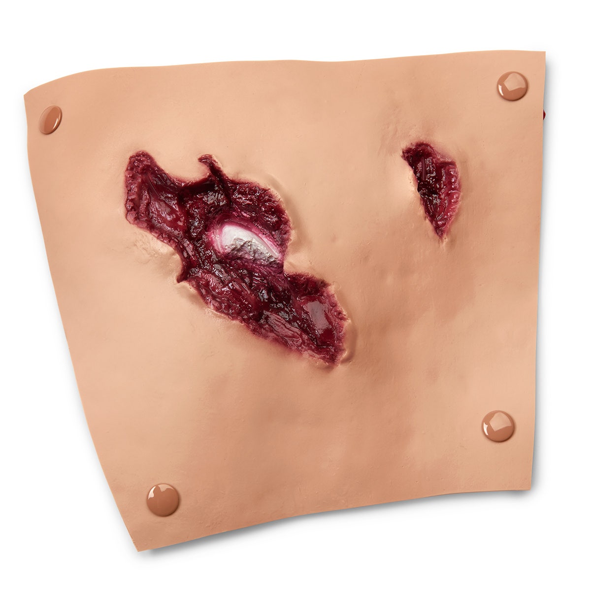 800-6819-Compound Fracture - Femur