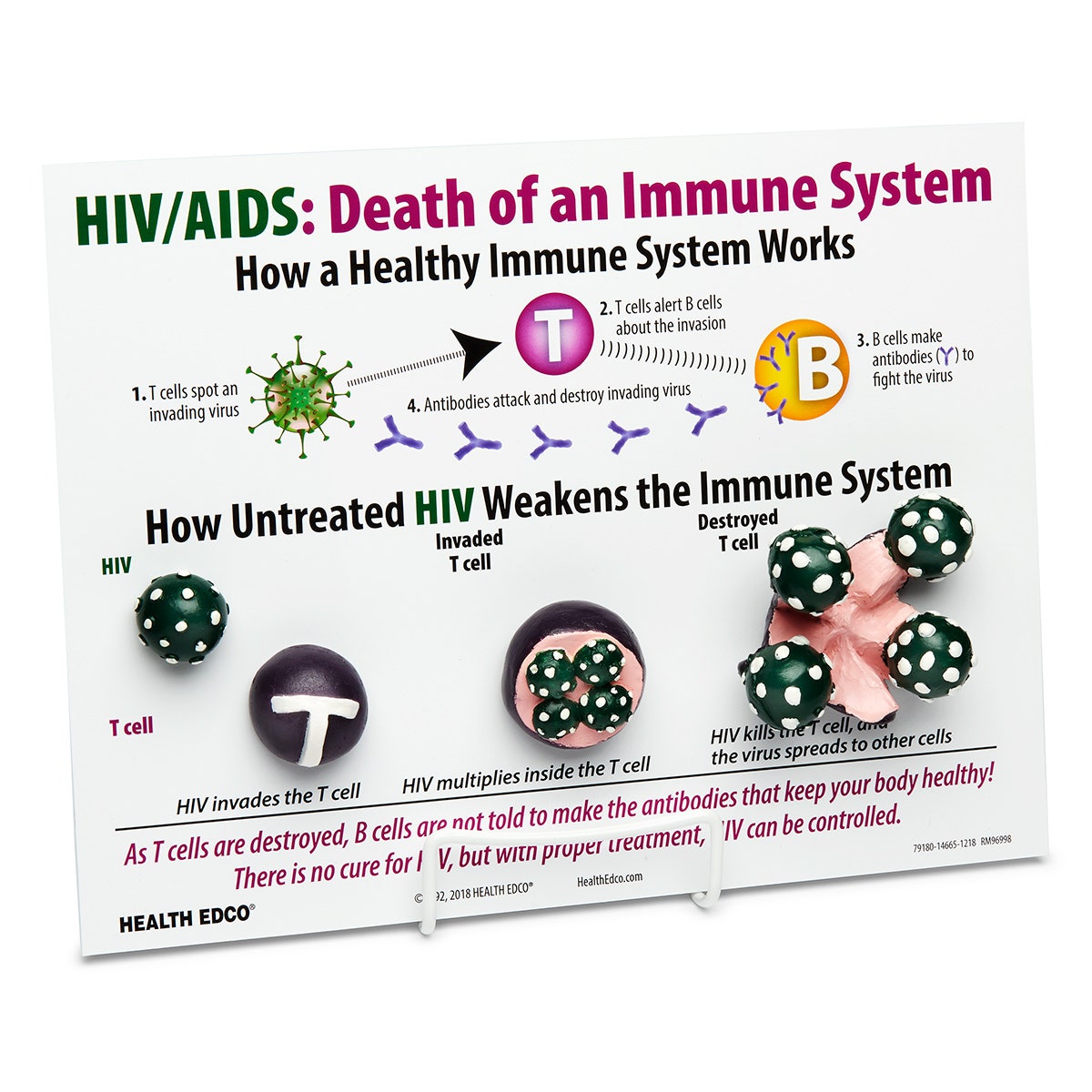 SB24867-Death of an Immune System - 3-D HIV Infection Model - 9 in. x 12 in.