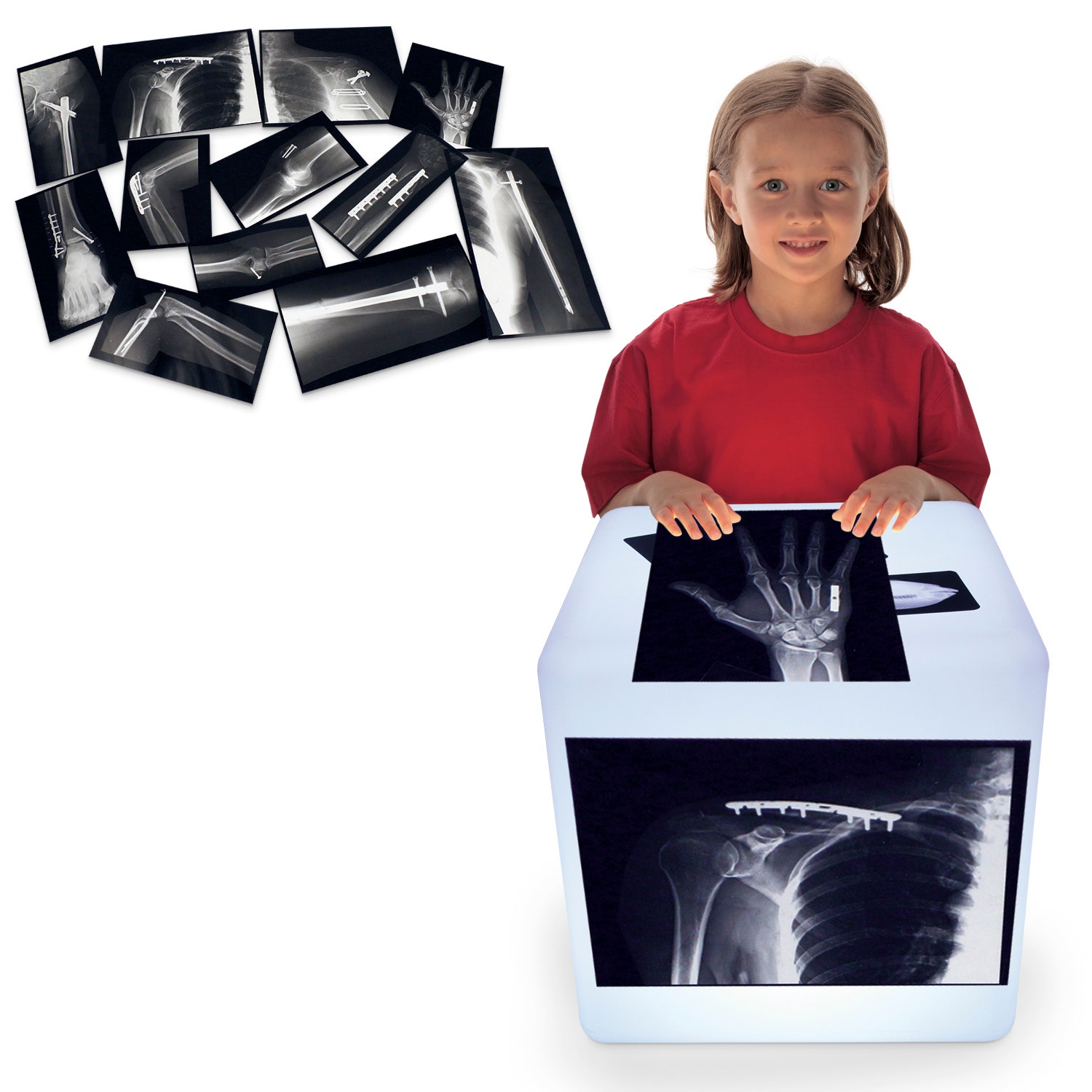 EL14149-Roylco® Fixed Bone X-Rays