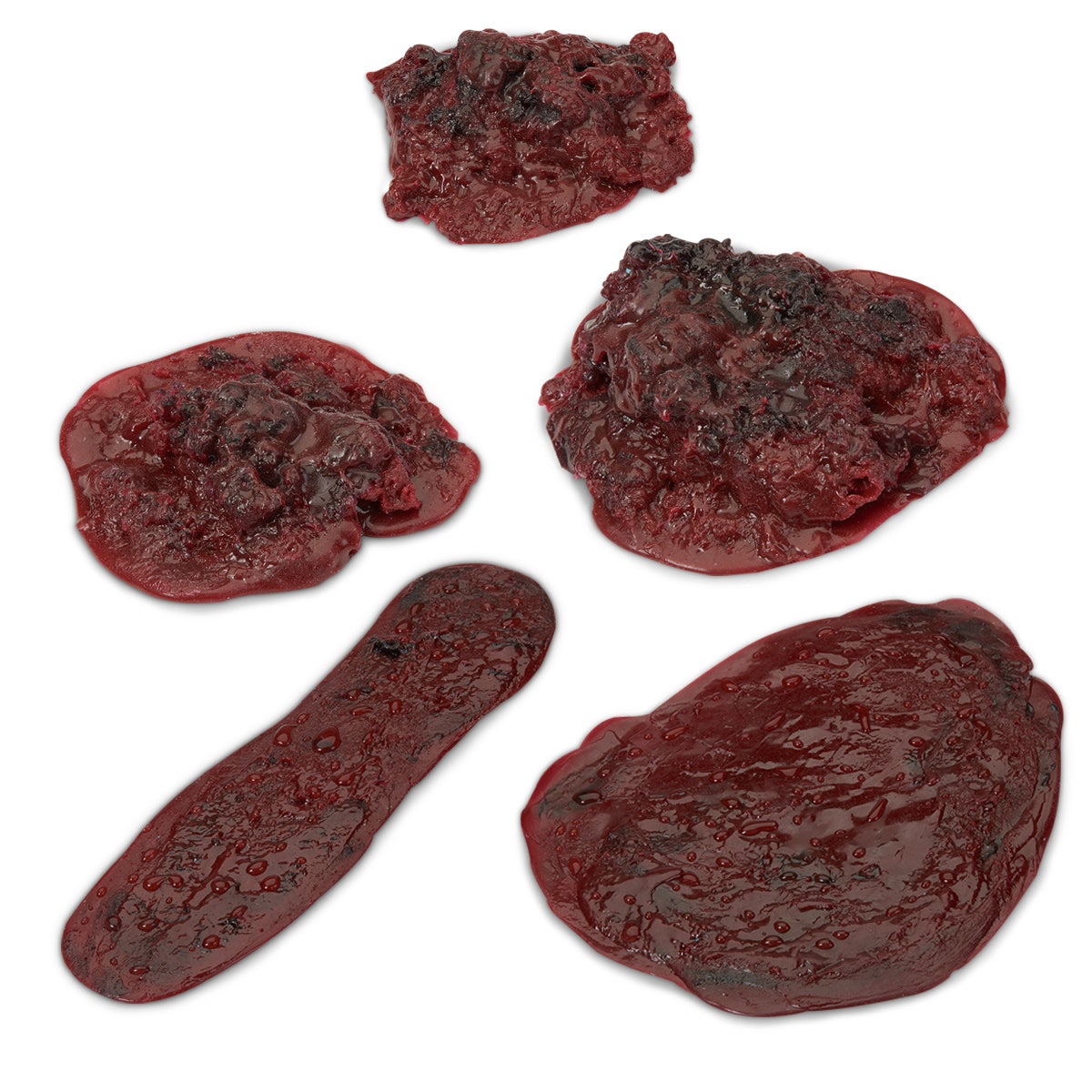 LF00714-Life/form® Clots and Hemorrhages - Set of 5