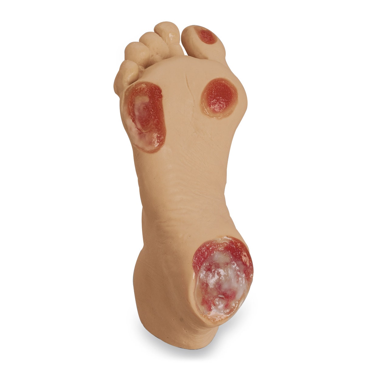 X0000LF00933-Life/form® Elderly Pressure Ulcer Foot