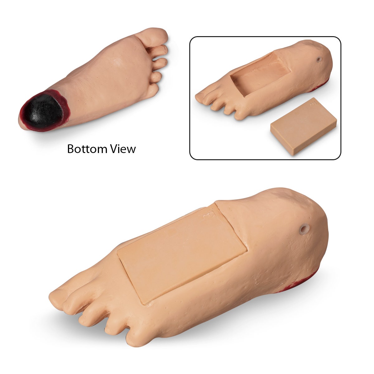 LF04084-Life/form® GERi™ and KERi™ Optional Edema Foot with Deep Tissue Injury - Light