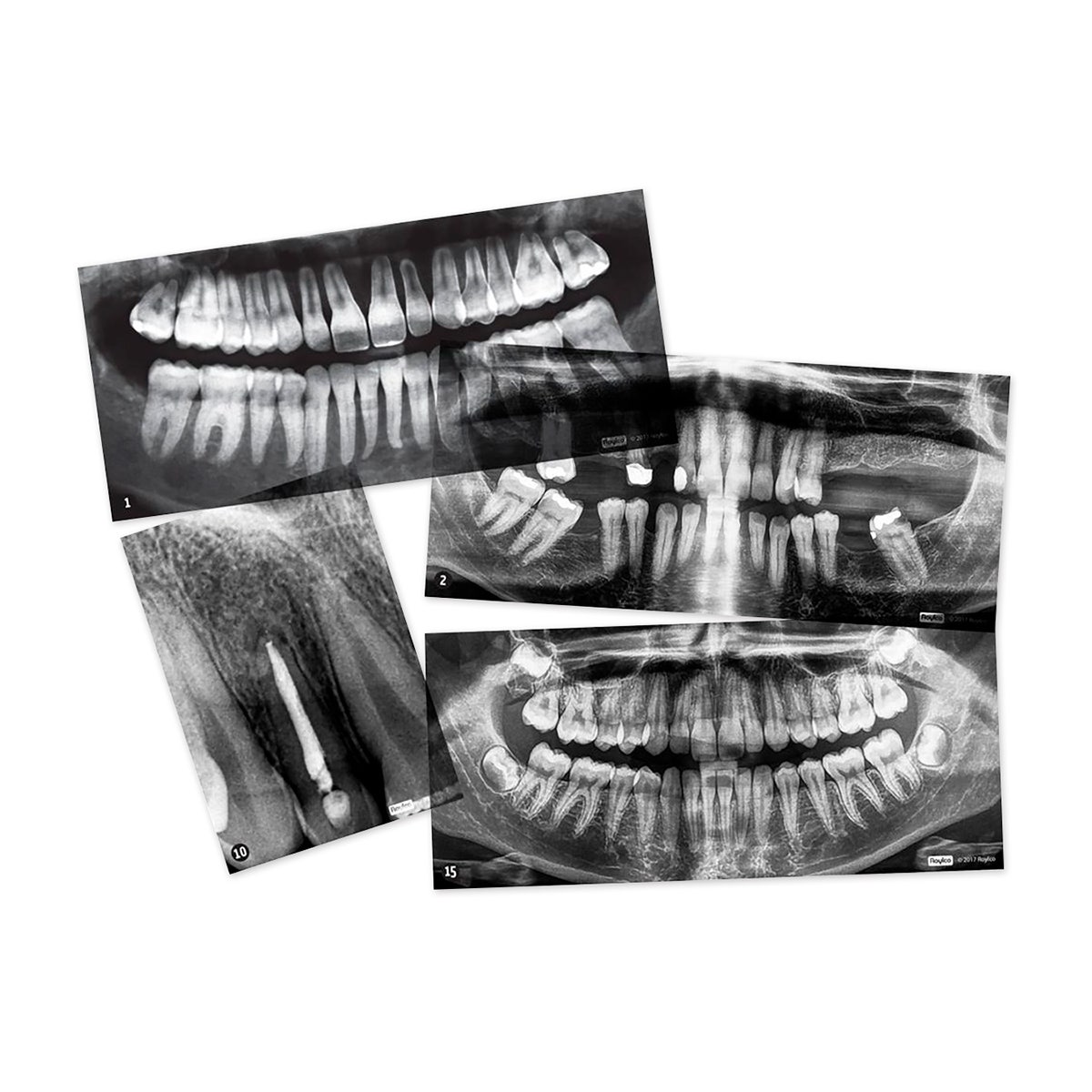 NE40562-Dental X-Rays - Set of 15