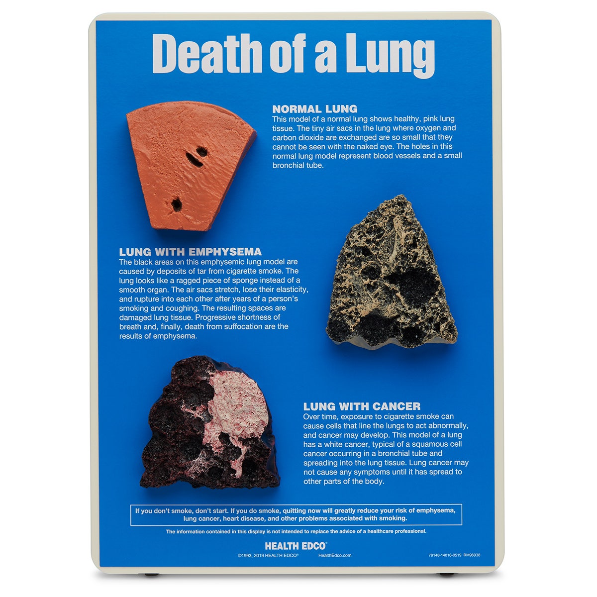 SB23236-Death of a Lung Model - 9 in. x 12 in.