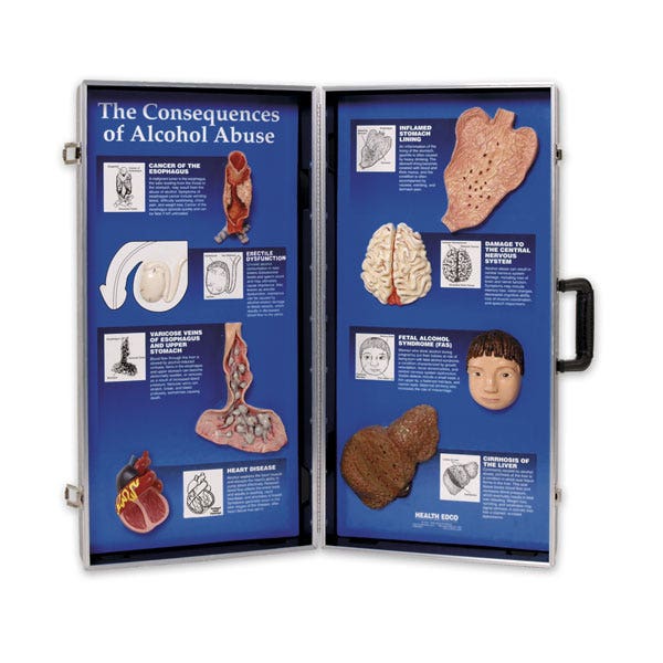 X0000SB23378-Consequences of Abuse Display