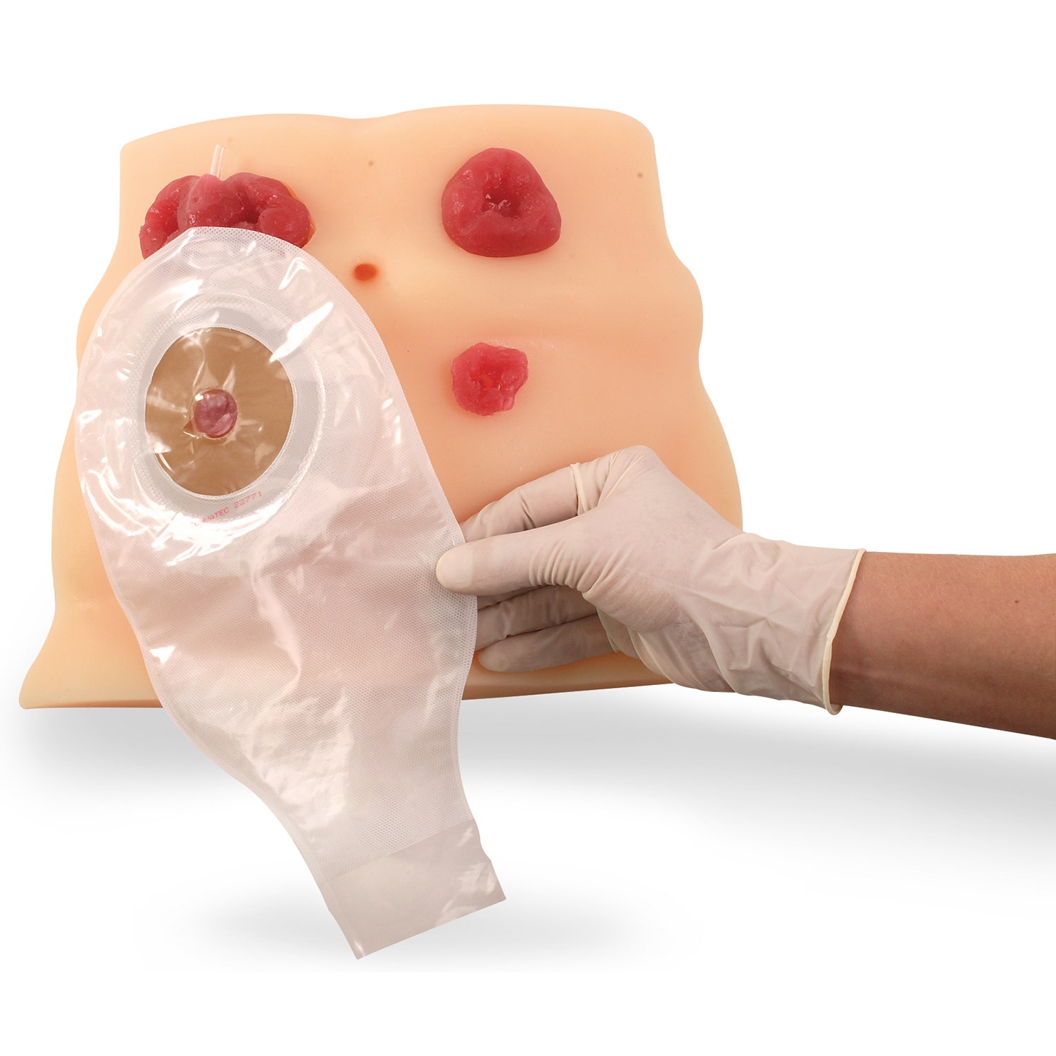 SB23501-Ostomy Care Model