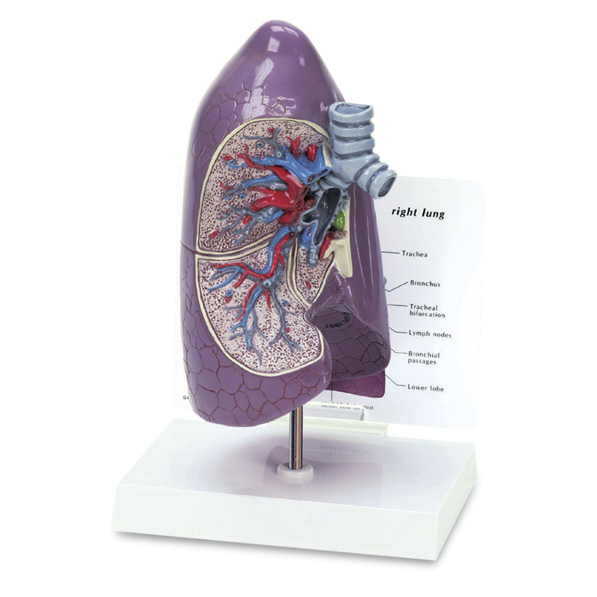 SB28414-Normal Lung Model - 9 in. x 5-1/2 in. x 5-1/4 in.