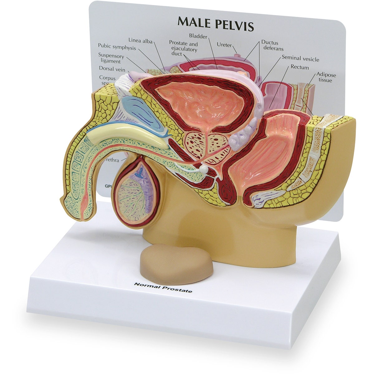 SB32598-Male Pelvis Model - 7 in. x 1 in. x 4-3/4 in.