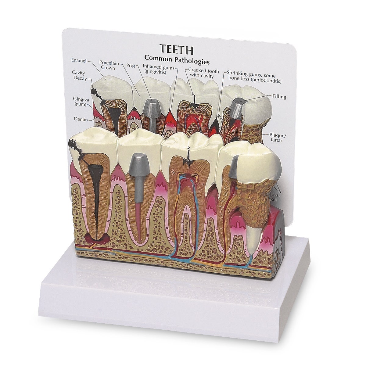 SB35432-Teeth Model - 5-1/2 in. x 2 in. x 3-1/2 in.