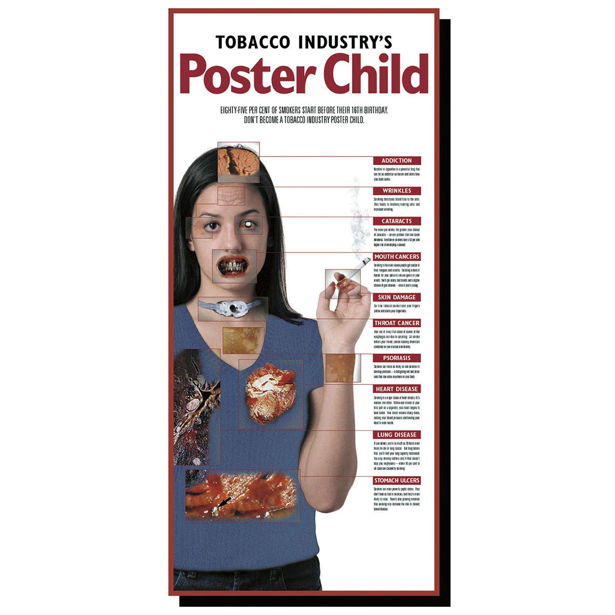 SB39918-Tobacco Industry’s Poster Child - 25 in. x 12 in.