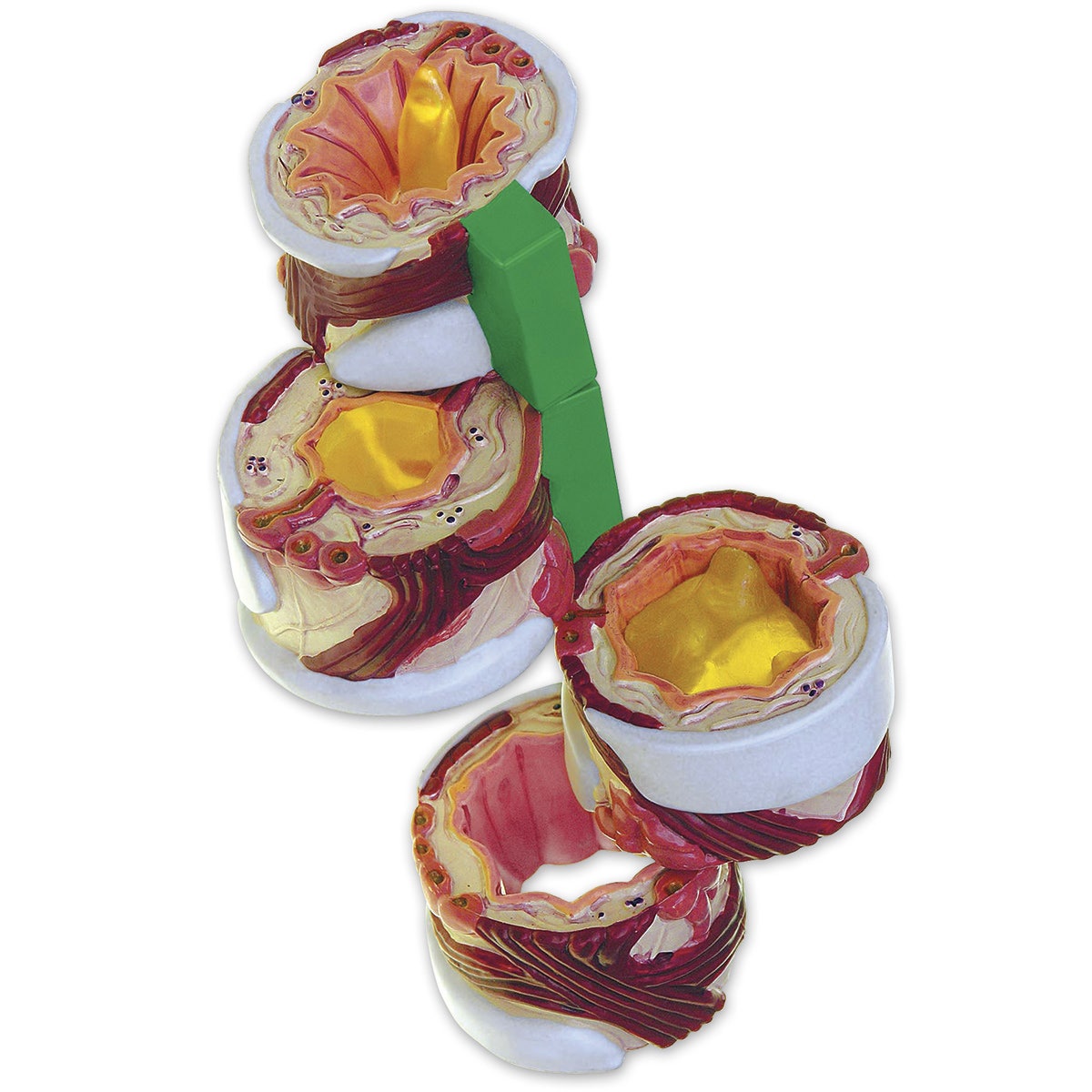 SB42962-Bronchus Model - 4 Part - 3-3/4 in. x 1-1/2 in. dia.