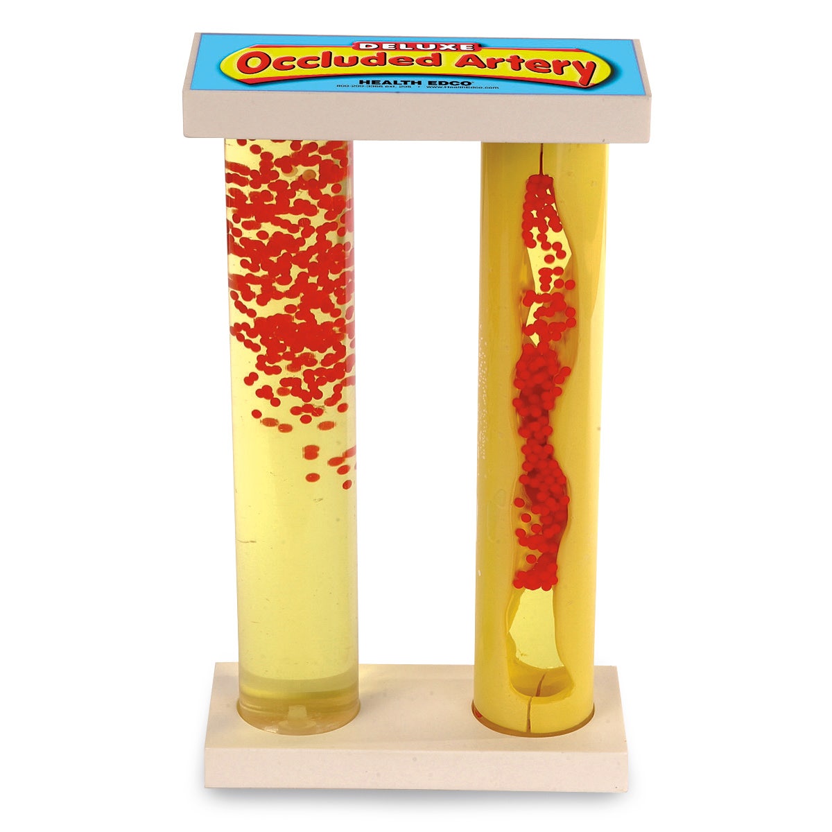 SB43034-Deluxe Occluded Artery Model