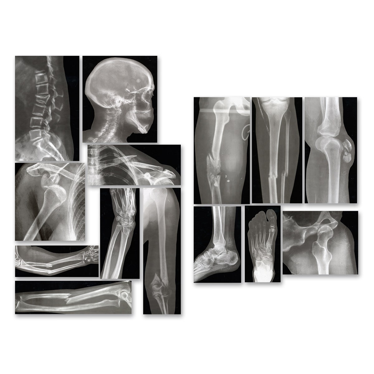 SB43367-Roylco® Broken Bones X-Rays™ - Set of 15