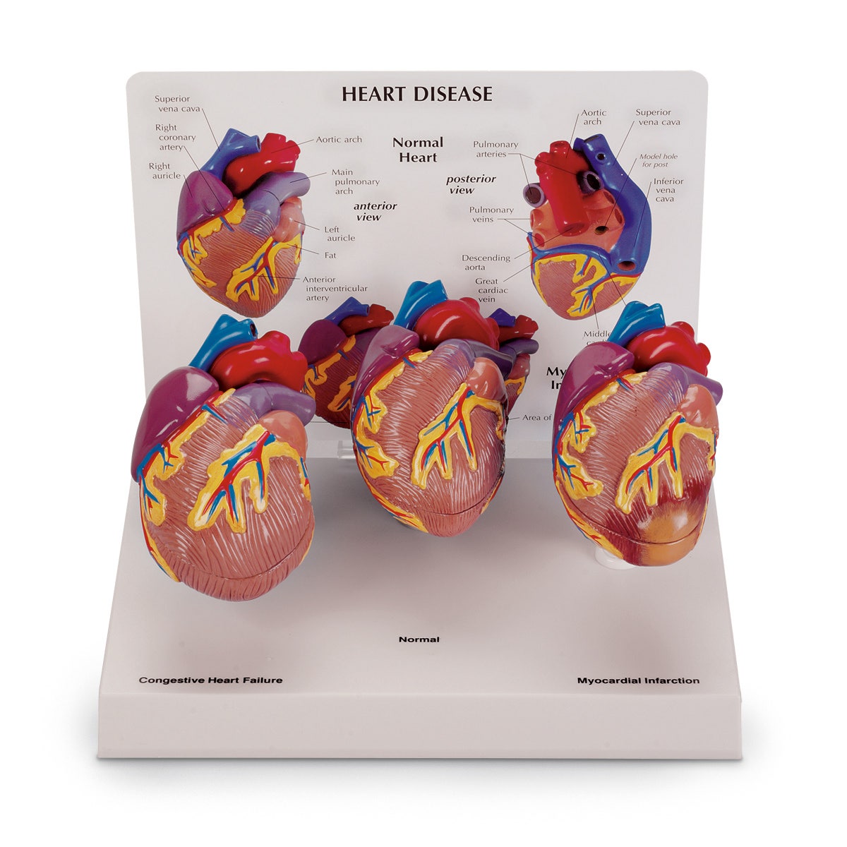 SB44893-3-Piece Mini Heart Set Models