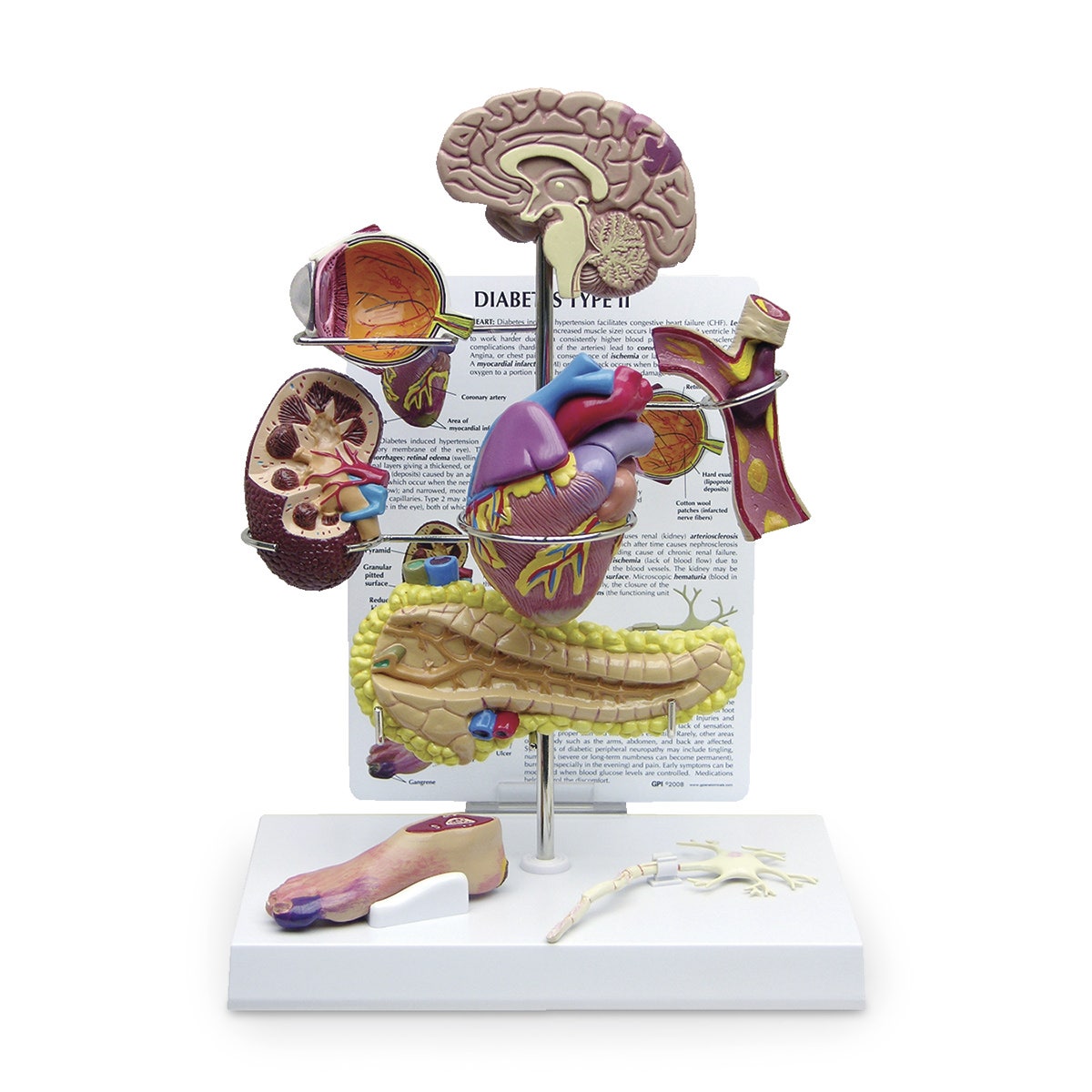 SB46335-Type 2 Diabetes Models