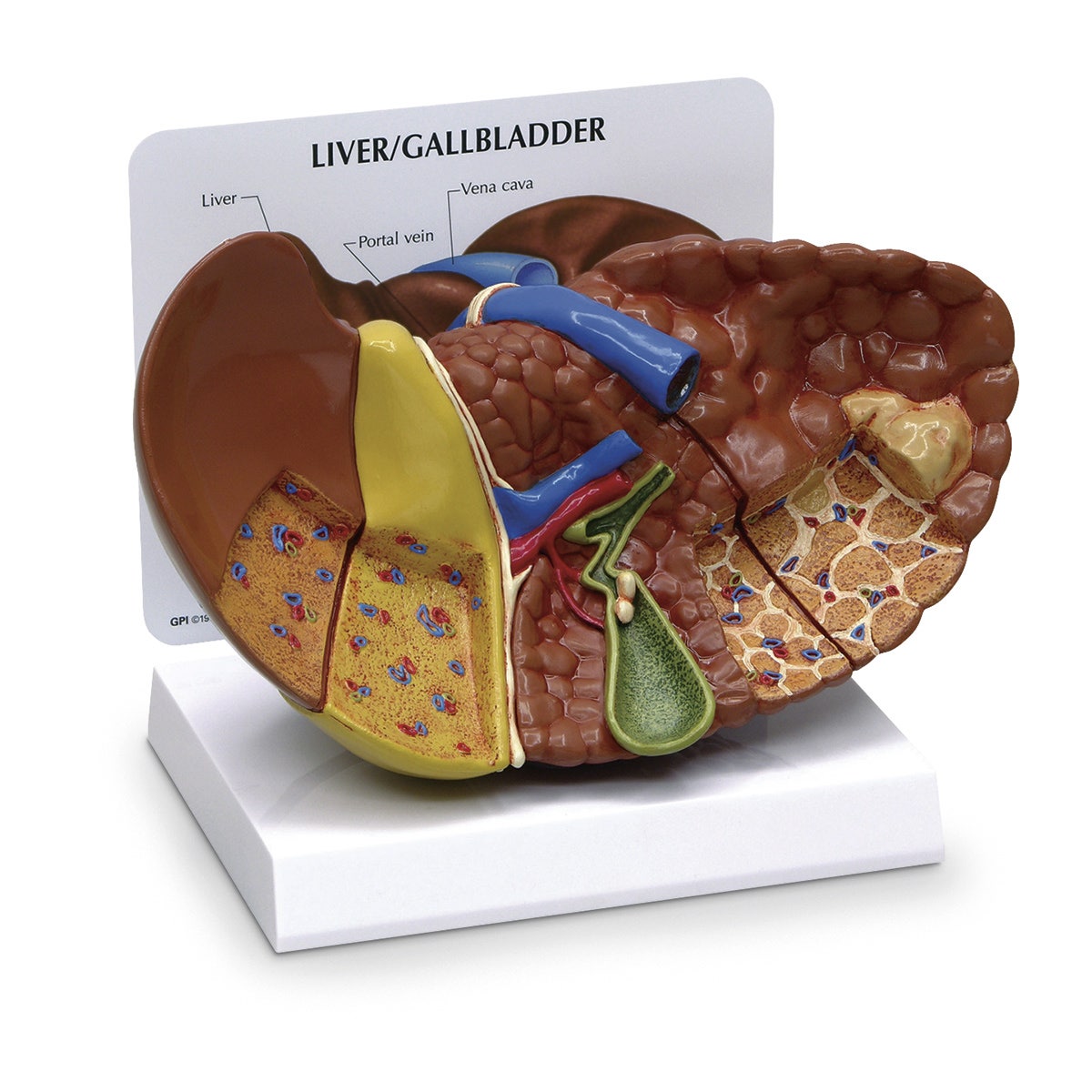 SB46336-Liver Model with Pathologies - 8 in. x 4-1/2 in. x 5-1/2 in.