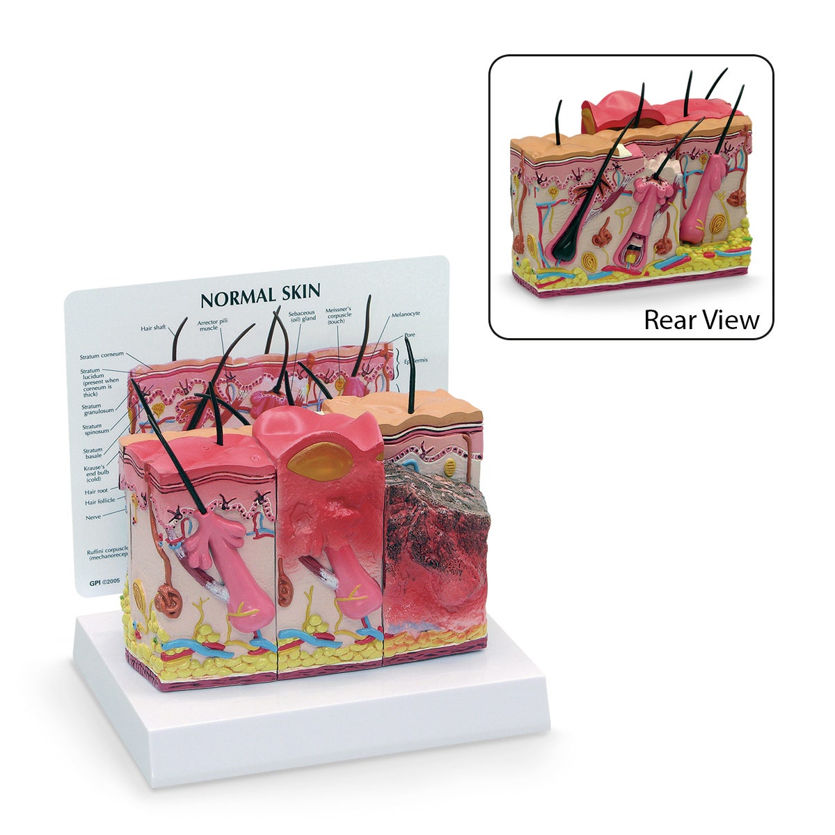 SB46482-Skin Burn/Normal Model