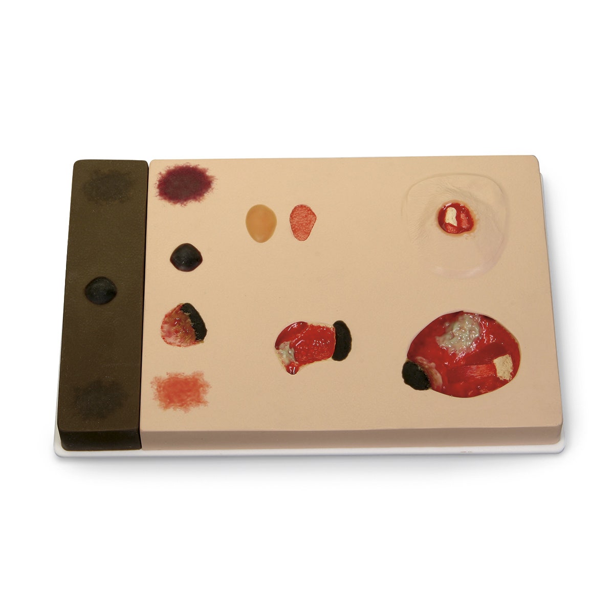 SB46506-‘Pat’ Pressure Ulcer Model™