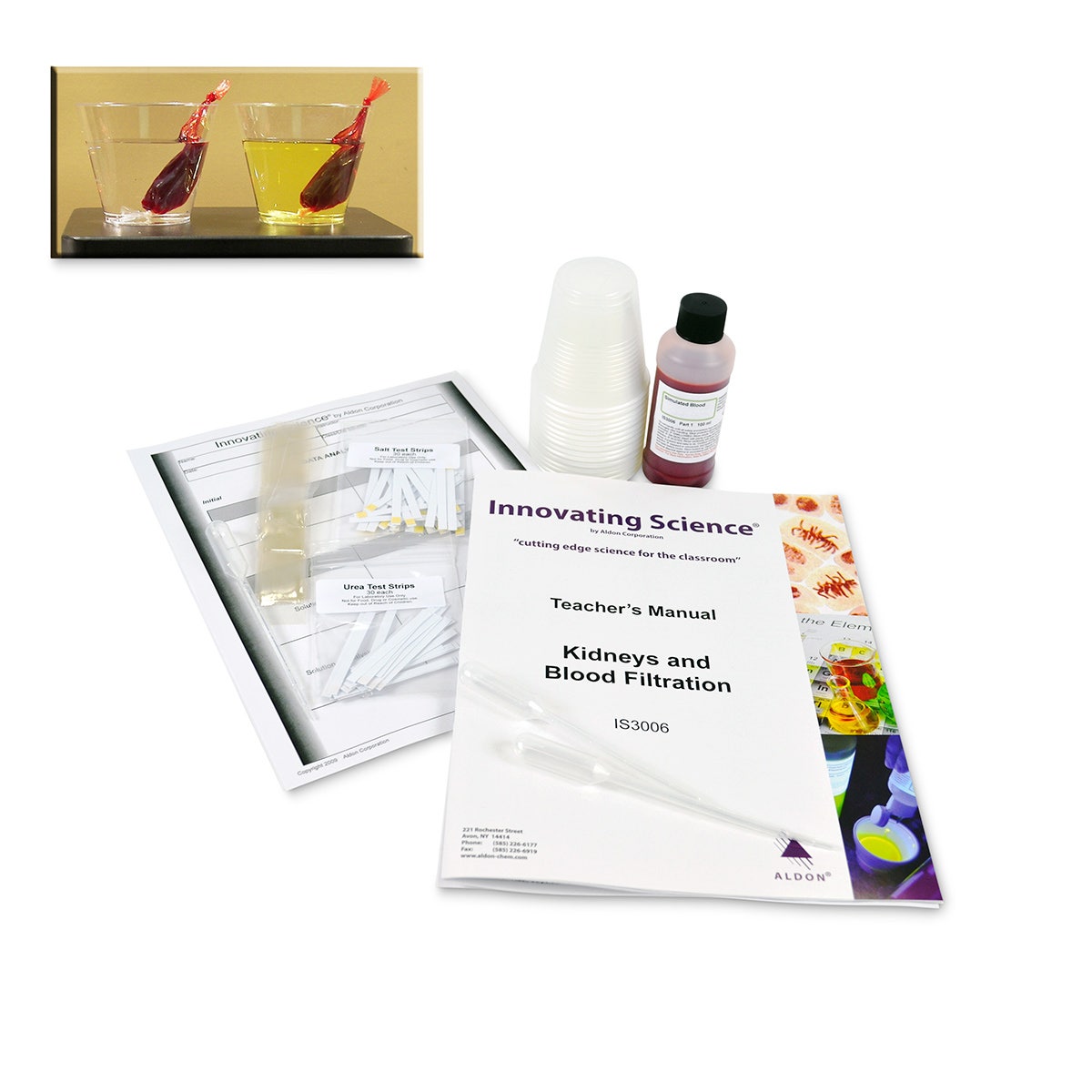 SB47397-Kidneys and Blood Filtration Kit