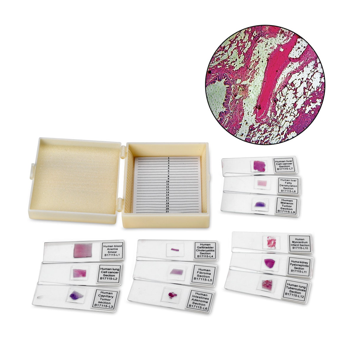 SB47764-Student Grade Slide Set - Human Pathology