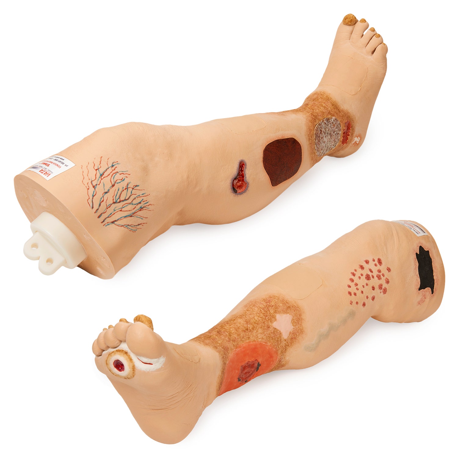 SB50123-Vinnie Venous Insufficiency Leg