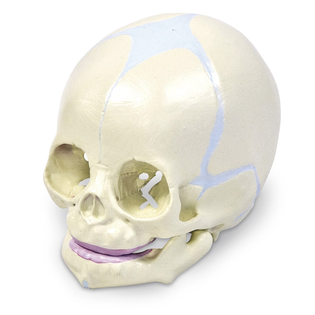SB50958-Human Fetal Skull