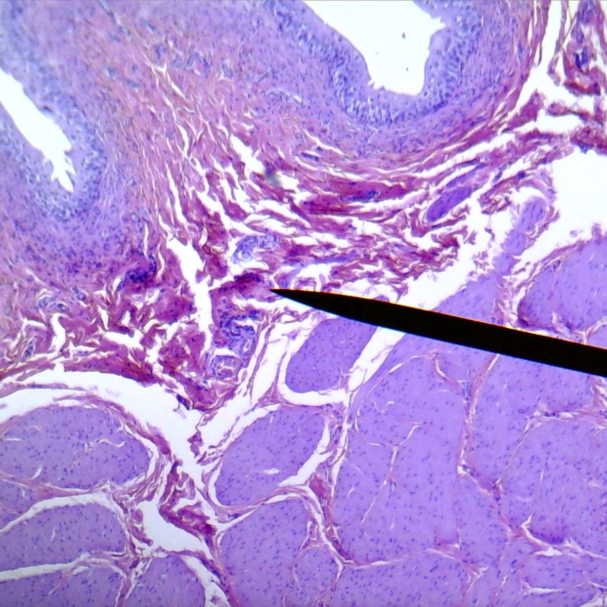 SB51582-Transitional epithelium, ureter or bladder, section