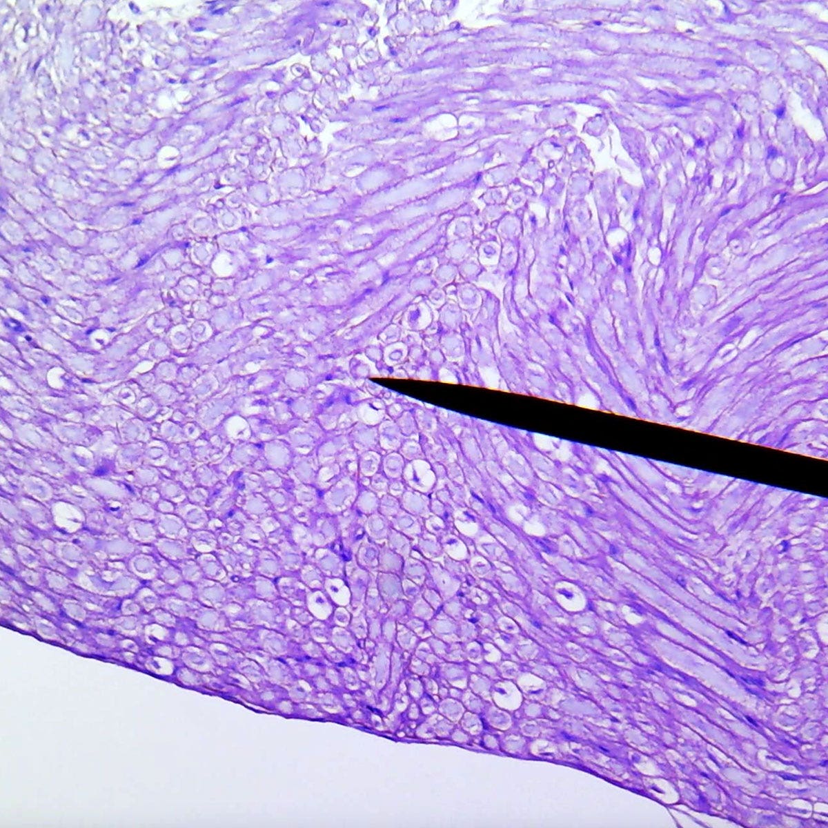 SB51624-Peripheral nerve, cross section and longitudinal section