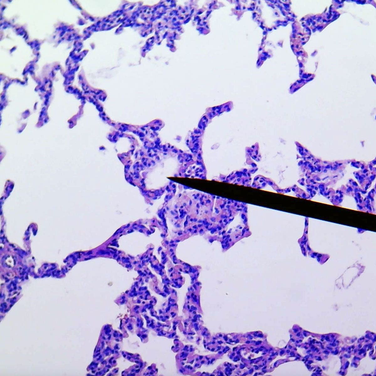 SB51645-Lung, human, section of normal tissue