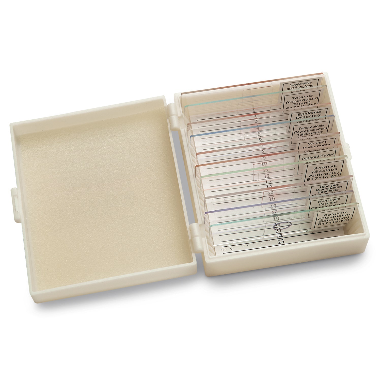 SB52191-Deadly Human Diseases - Set of 10 Slides