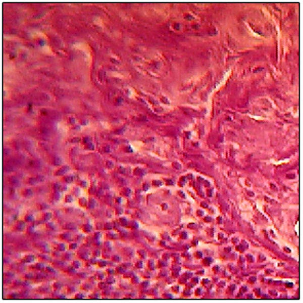 SL10242-Microscope Slide: Muscle - Three Types - Human