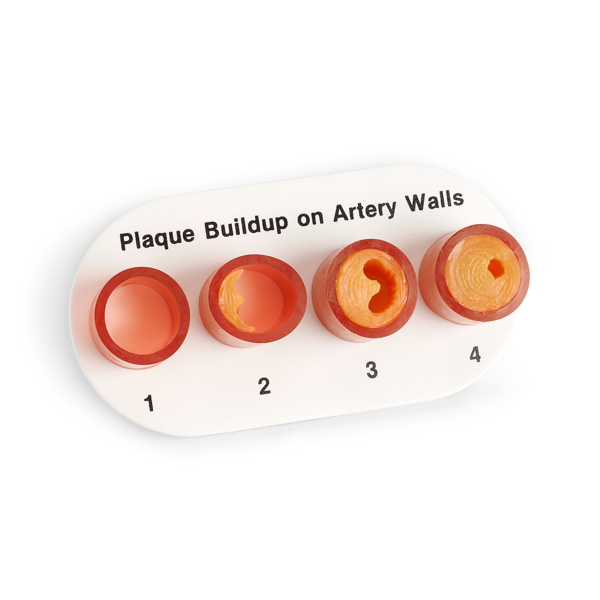 WA09742-Nasco Artery Section with Blockage Model