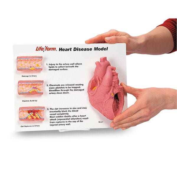 WA20292-Nasco Artery/Heart Disease Display