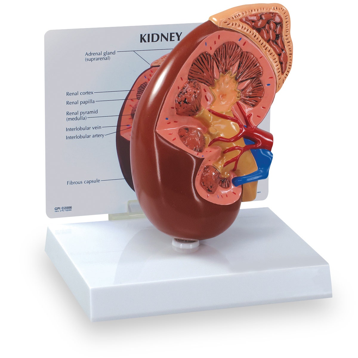 WA21315-Kidney Model