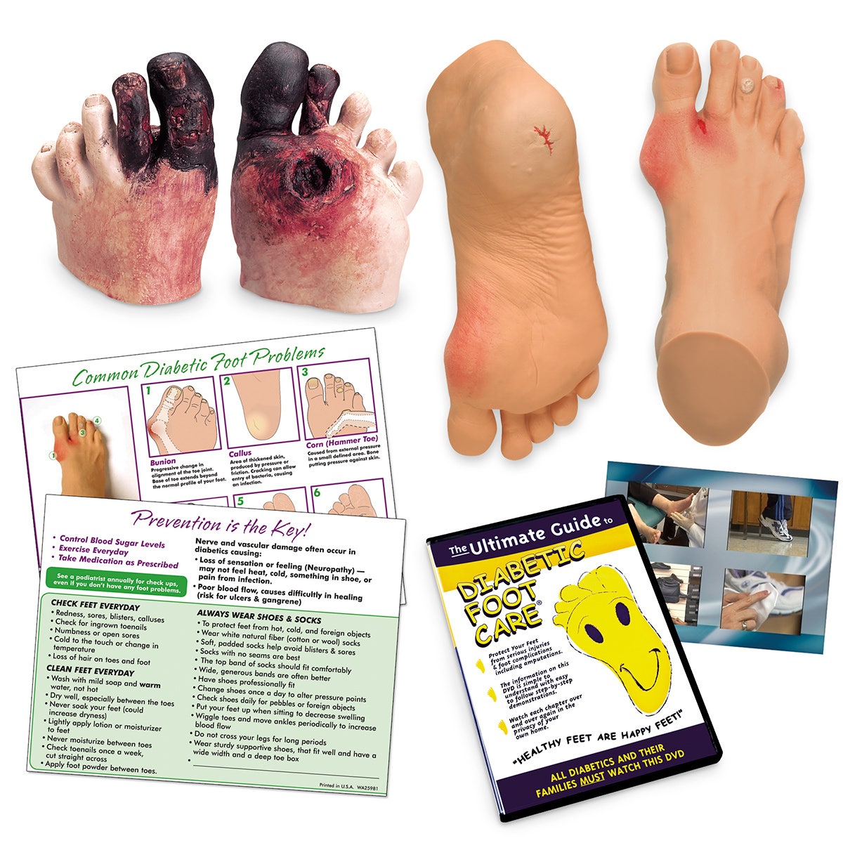 WA29842-Diabetic Foot Care Education
