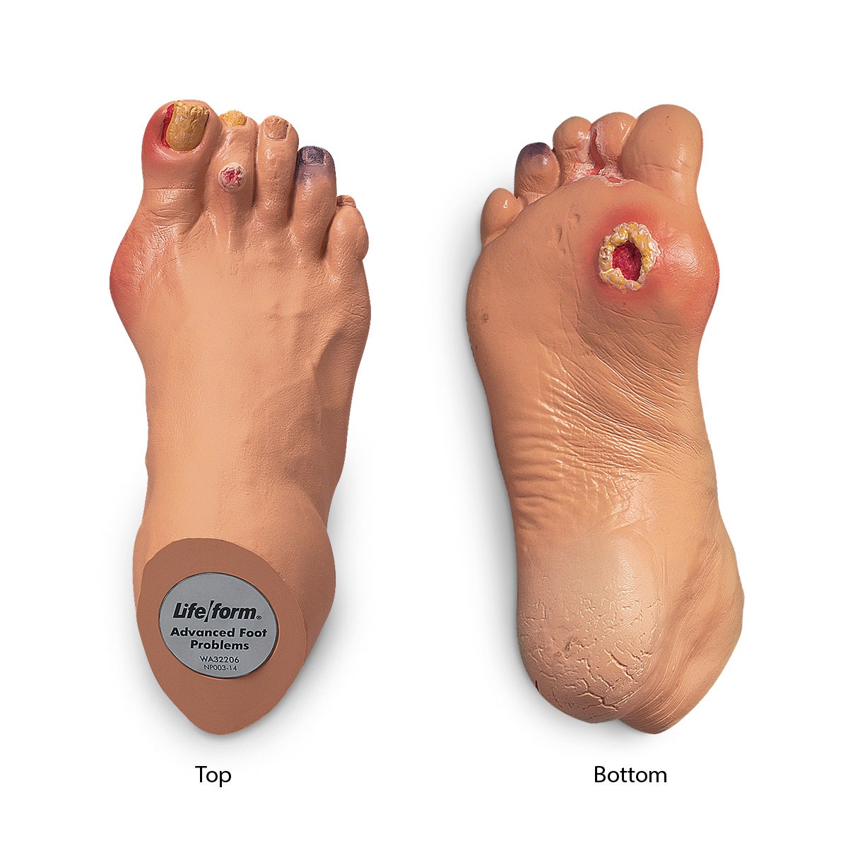 WA32206-Nasco Advanced Foot Problems